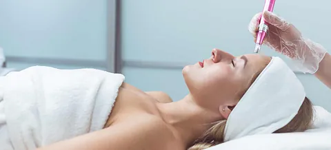 Fractional Needling